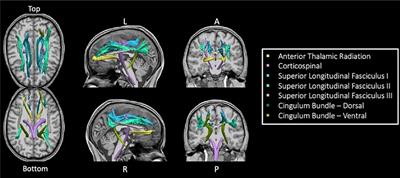 Tract-based analyses of white matter in schizophrenia, bipolar disorder, aging, and dementia using high spatial and directional resolution diffusion imaging: a pilot study